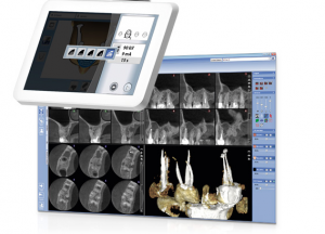 Planmeca 3D CT-skanner