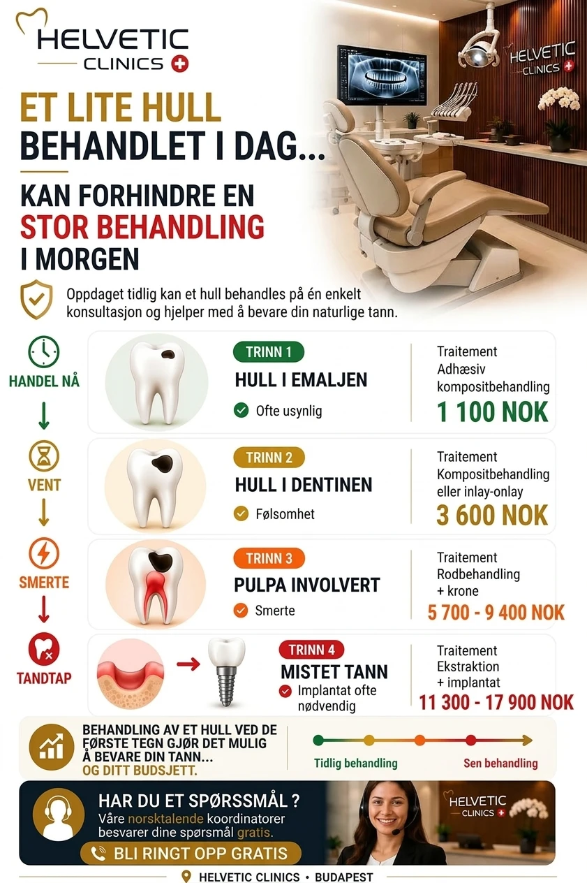 Infografikk som viser viktigheten av tidlig tannbehandling og utviklingen av hull i tennene hos Helvetic Clinics Budapest.