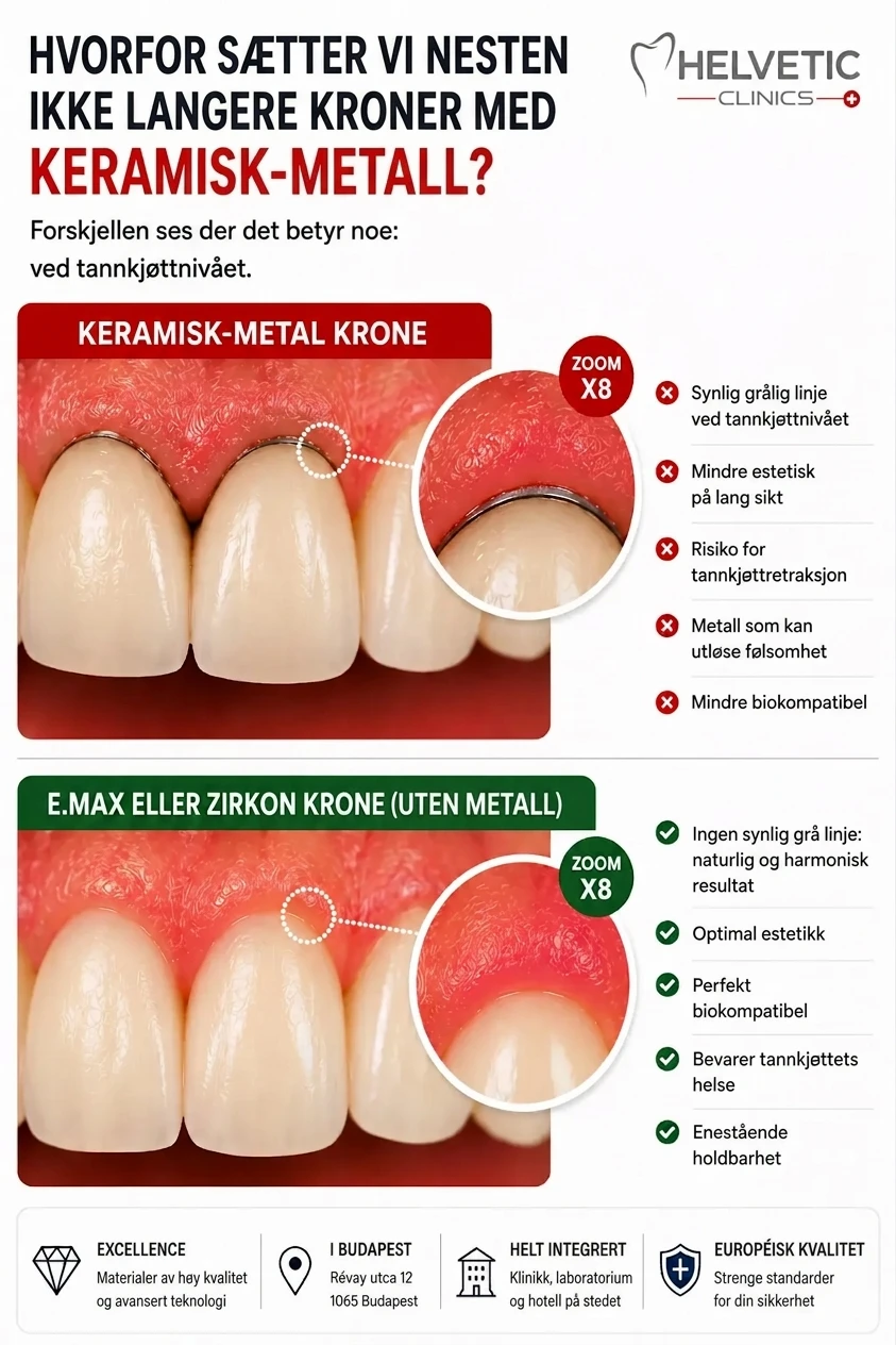 Infografikk fra Helvetic Clinics som sammenligner moderne metallfrie E.max- og Zirkon-kroner med eldre keramisk-metall-kroner. Grafikken forklarer hvorfor de sistnevnte nesten ikke brukes lenger, med fokus på forskjellen ved tannkjøttnivået. To nærbilder av tenner viser: for keramisk-metall-kroner, en synlig grålig linje og risiko for tannkjøttretraksjon; for metallfrie zirkon- og E.max-kroner, et naturlig og harmonisk resultat uten grå linje, optimal estetikk og bevart tannkjøtthelse. Nederst er ikoner som fremhever høy kvalitet, beliggenhet i Budapest, integrerte tjenester og europeisk standard.