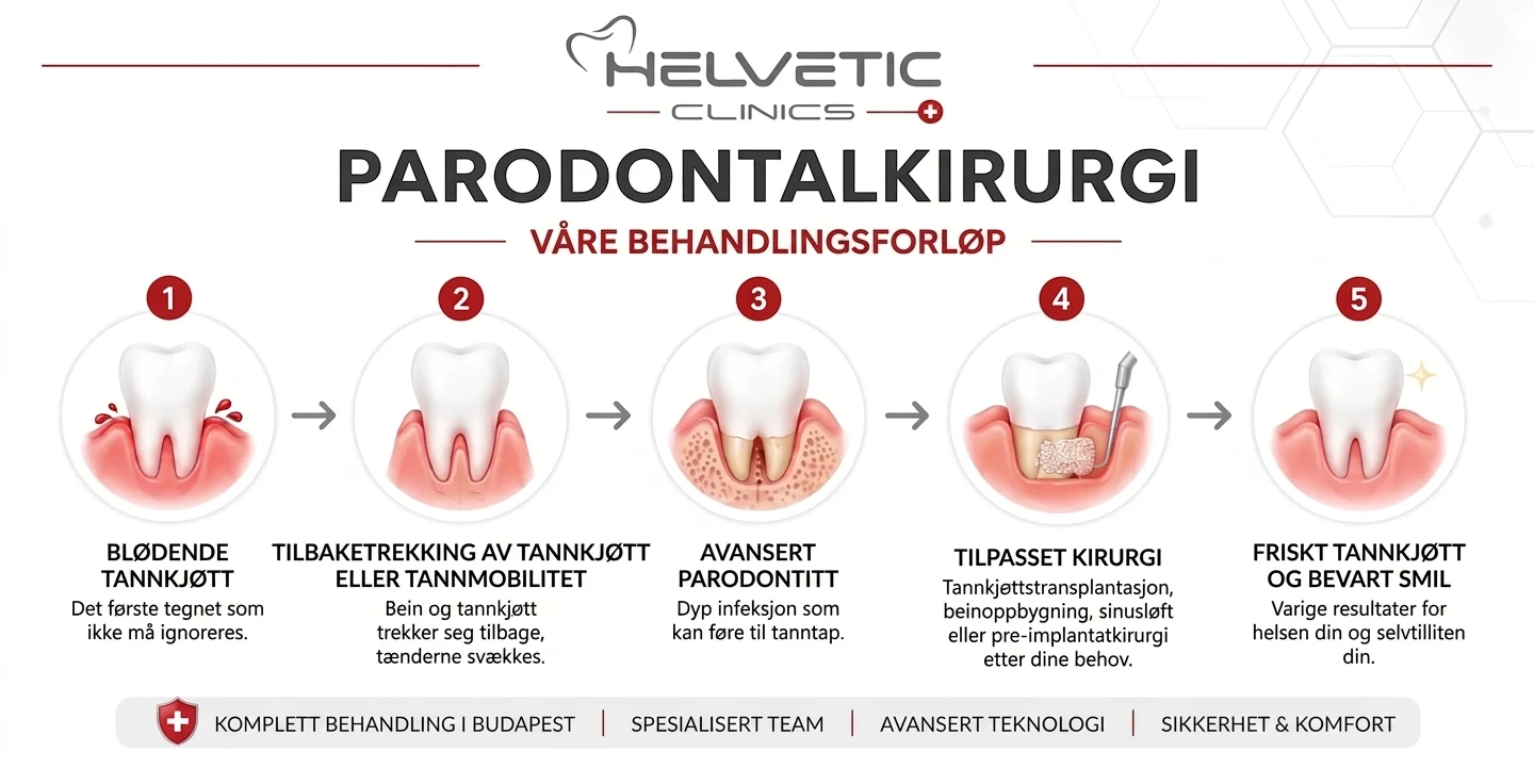 Illustrasjon av et 5-trinns behandlingsforløp for parodontalkirurgi ved Helvetic Clinics Budapest, fra blødende tannkjøtt til et friskt og bevart smil