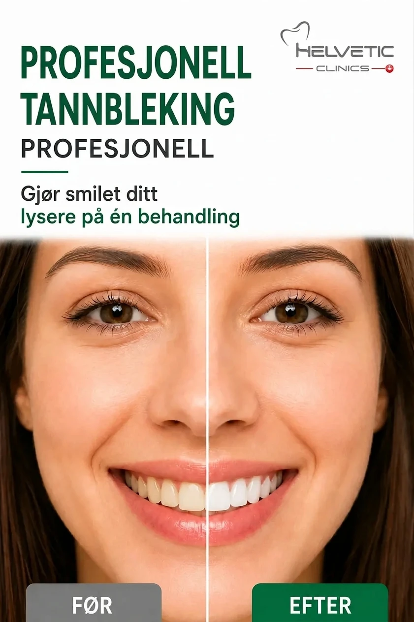 Før- og etter-bilde av en smilende kvinne som viser effekten av profesjonell tannbleking hos Helvetic Clinics. Venstre side av bildet, merket med FØR, viser tennene med en gulere nyanse. Høyre side, merket med EFTER, viser et strålende hvitt smil. Teksten på bildet bekrefter at behandlingen gjør smilet lysere på én behandling.