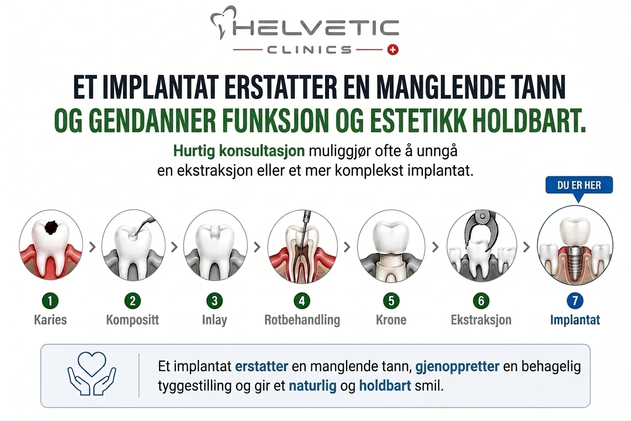 Tannimplantat og tannbehandling hos Helvetic Clinics: En visuell guide. Infografikken viser en prosess i 7 trinn for tannbehandling, fra karies (tannråte) til implantatplassering. Den forklarer hvordan et tannimplantat erstatter en manglende tann, gjenoppretter funksjon, tyggestilling og gir et naturlig, holdbart smil. Trinnene er: Karies, Kompositt, Inlay, Rotbehandling, Krone, Ekstraksjon, Implantat.