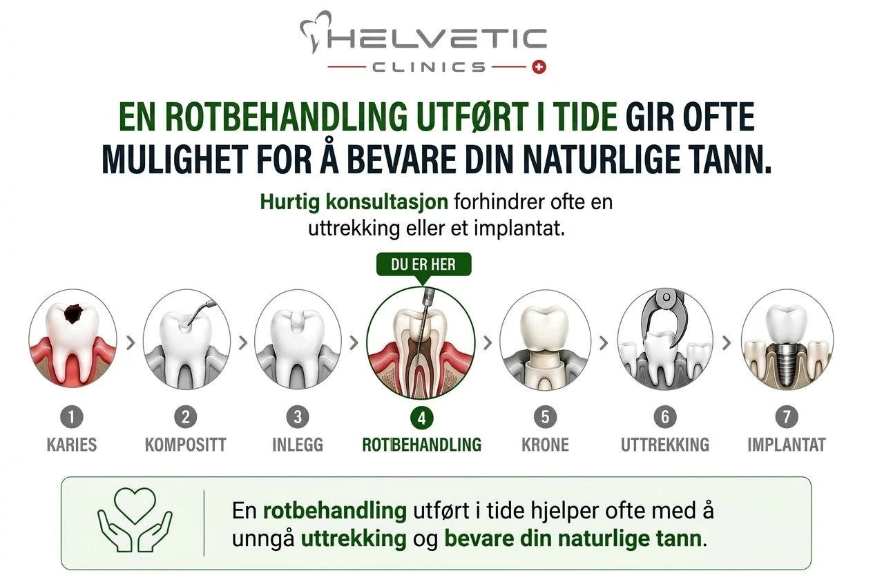 Infografikk fra Helvetic Clinics som viser syv stadier av tannbehandling for å redde en tann. Overskriften påpeker: «EN ROTBEHANDLING UTFØRT I TIDE GIR OFTE MULIGHET FOR Å BEVARE DIN NATURLIGE TANN.» En sekvens med piler går fra 1. Karies, 2. Kompositt, og 3. Innlegg, til det fremhevede fjerde steget: 4. Rotbehandling (med teksten «DU ER HER»). Etter dette vises 5. Krone, 6. Uttrekking, og 7. Implantat. Nederst er det en tekstboks som sier: «En rotbehandling utført i tide hjelper ofte med å unngå uttrekking og bevare din naturlige tann.»