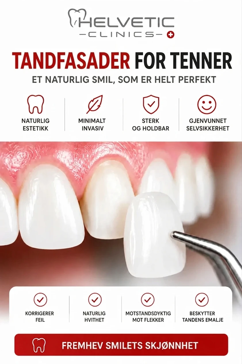 Nærbilde av en hvit tannfasade som plasseres på en tann, med infografikk fra Helvetic Clinics som fremhever fordeler som naturlig estetikk, sterk holdbarhet og beskyttelse av emaljen for et perfekt smil.